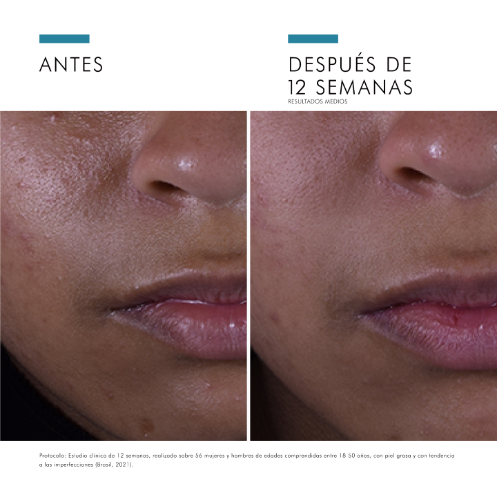 Comprar Silymarin CF Sérum 30ml Skinceuticals - Antioxidante para piel