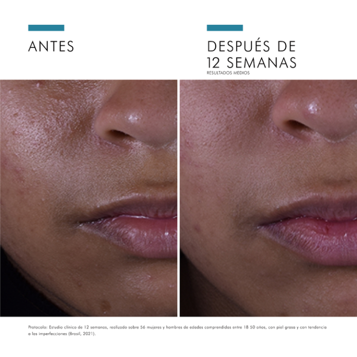 Comprar Silymarin CF Sérum 30ml Skinceuticals - Antioxidante para piel