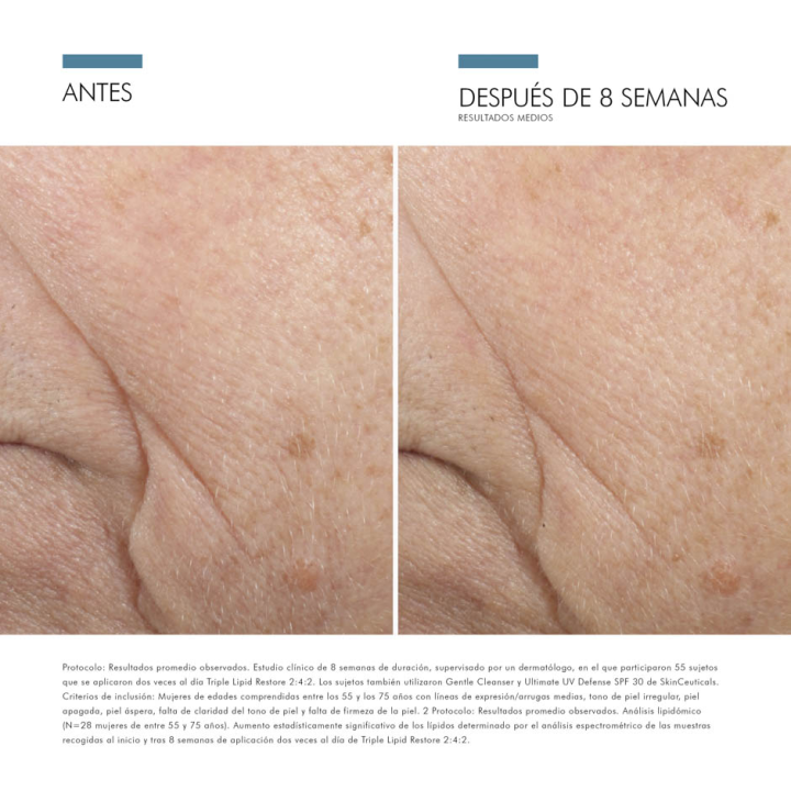 Comprar Triple Lipid Restore 2:4:2 SkinCeuticals al mejor precio - Far
