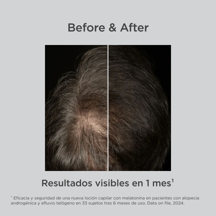 Comprar Lambdapil Melatonin Concentrate - Loción que Fortalece y revit