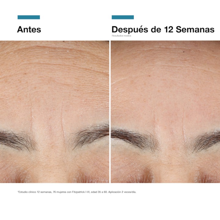 Advanced RGN-6 SkinCeuticals: Crema Regeneradora Post‑Tratamiento Láser | Farmacia Lisboa