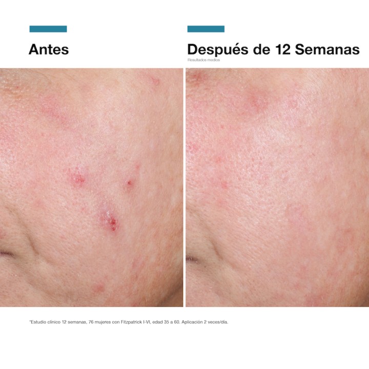 Advanced RGN-6 SkinCeuticals: Crema Regeneradora Post‑Tratamiento Láser | Farmacia Lisboa