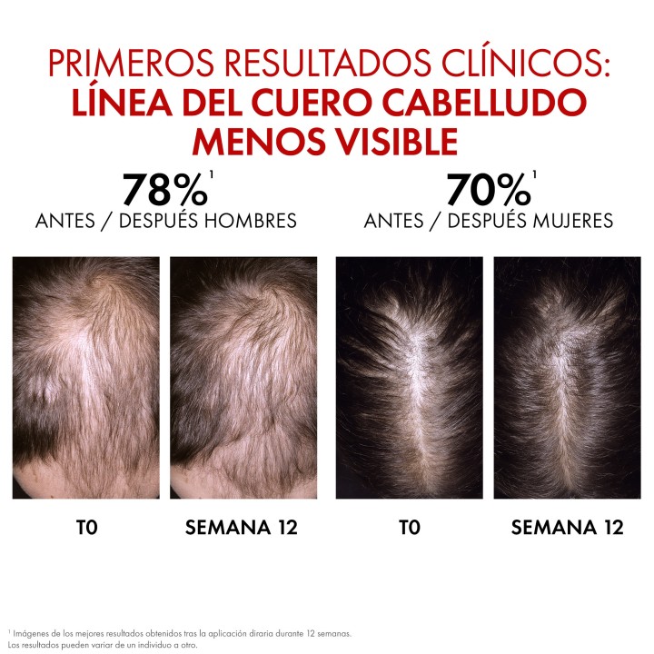 Vichy Dercos Aminexil Clinical R.E.G.E.N. Booster | Sérum anticaída y estimula crecimiento