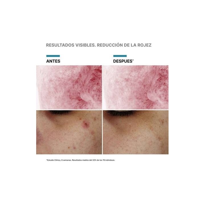 Phyto Corrective PDRN Serum SkinCeuticals 30 ml