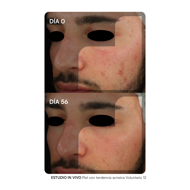 GH Probioderm Balance 30 Cápsulas de Probioticos Gema Herrerías