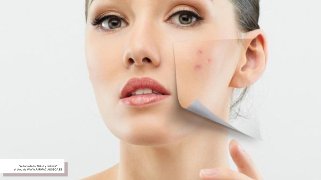6 pasos para cuidar tu piel grasa y redescubrir tu rostro